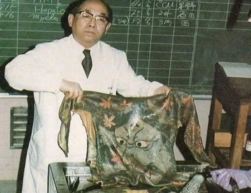 Dr. Katsunari Fukushi memeriksa spesimen kulit bertatu dalam makmal