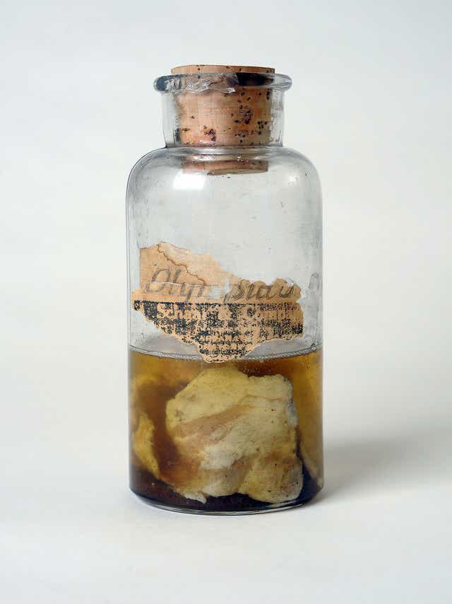 Balang kaca antik mengandungi spesimen daging Kentucky Meat Shower yang diawet