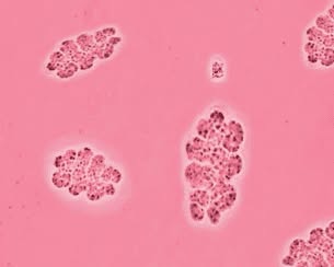Imej mikroskopik mikroalga Dunaliella salina dan bakteria Salinibacter ruber